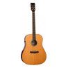 GUITARRA ACÚSTICA TANGLEWOOD SERIE NEW ROSEWOOD SMART DREADNOUGHT ELECTRIFICADA